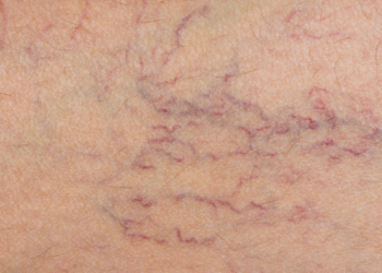 Comment avoir de belles jambes