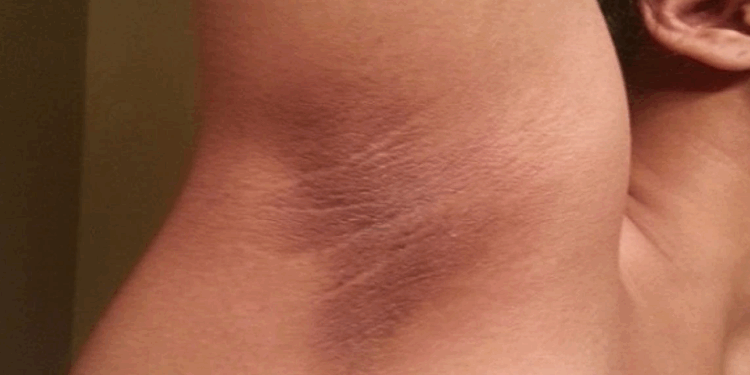 Risques de cancer: vous devriez consulter si vous avez ces taches sur votre corps 1 Risques de cancer: vous devriez consulter si vous avez ces taches sur votre corps Capture decran 2025 09 24 165406