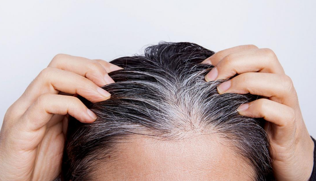 Pourquoi les jeunes ont-ils des cheveux blancs de plus en plus tôt ? 3 Pourquoi les jeunes ont-ils des cheveux blancs de plus en plus tôt ? Capture decran 2025 10 30 144039