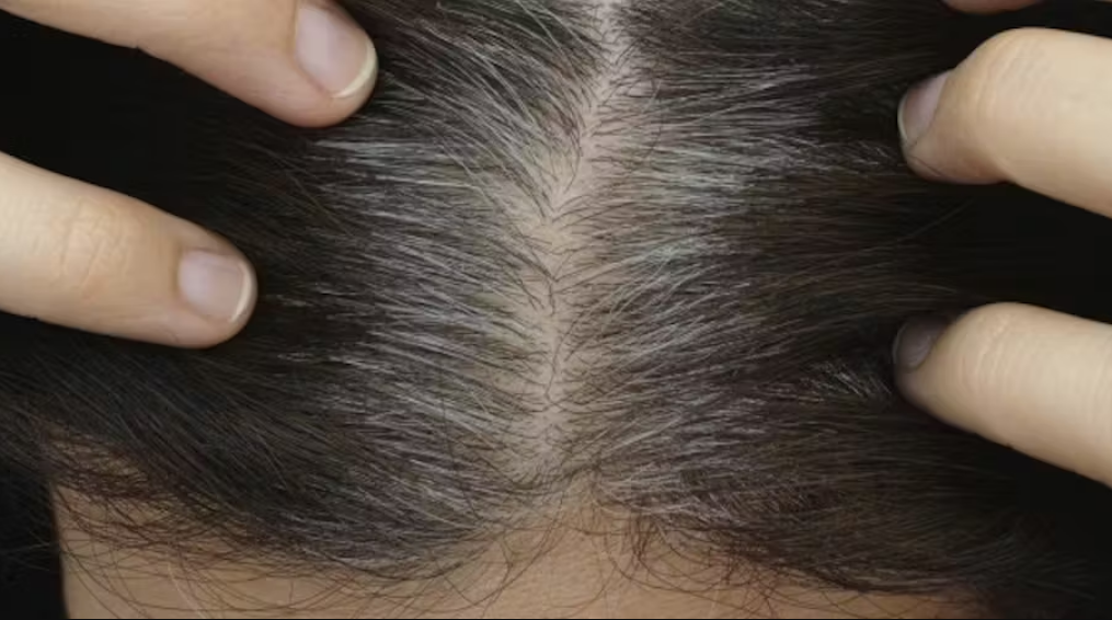 Pourquoi les jeunes ont-ils des cheveux blancs de plus en plus tôt ? 4 Pourquoi les jeunes ont-ils des cheveux blancs de plus en plus tôt ? Capture decran 2025 10 30 144049