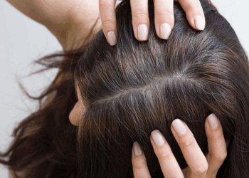 Pourquoi les jeunes ont-ils des cheveux blancs de plus en plus tôt ?