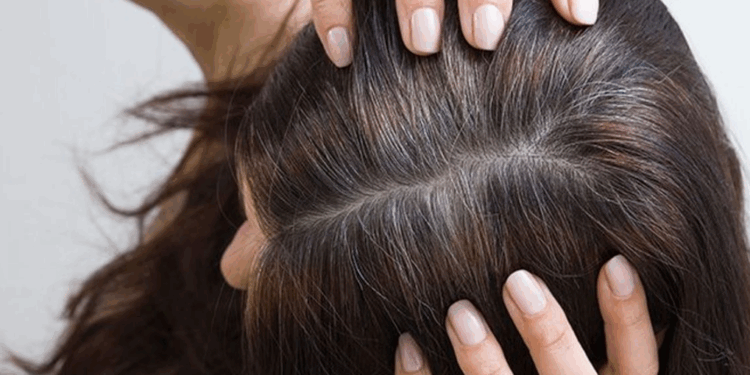 Pourquoi les jeunes ont-ils des cheveux blancs de plus en plus tôt ? 1 Pourquoi les jeunes ont-ils des cheveux blancs de plus en plus tôt ? Capture decran 2025 10 30 144055