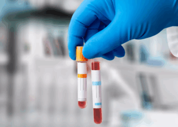 Voici le taux de cholestérol à ne pas dépasser pour éviter l'AVC 10 Voici le taux de cholestérol à ne pas dépasser pour éviter l'AVC Capture decran 2025 11 04 151427