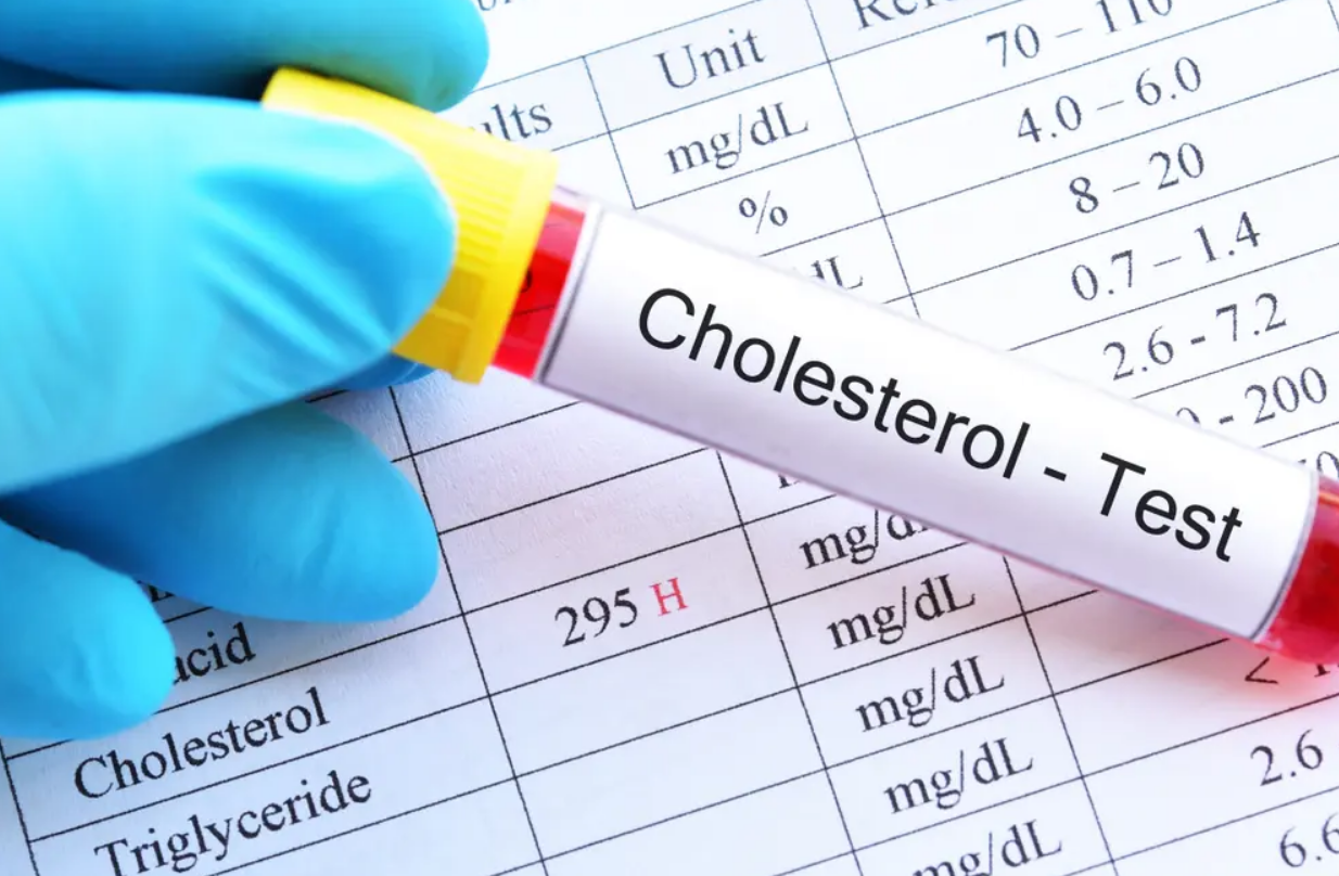 Voici le taux de cholestérol à ne pas dépasser pour éviter l'AVC 4 Voici le taux de cholestérol à ne pas dépasser pour éviter l'AVC Capture decran 2025 11 04 151438