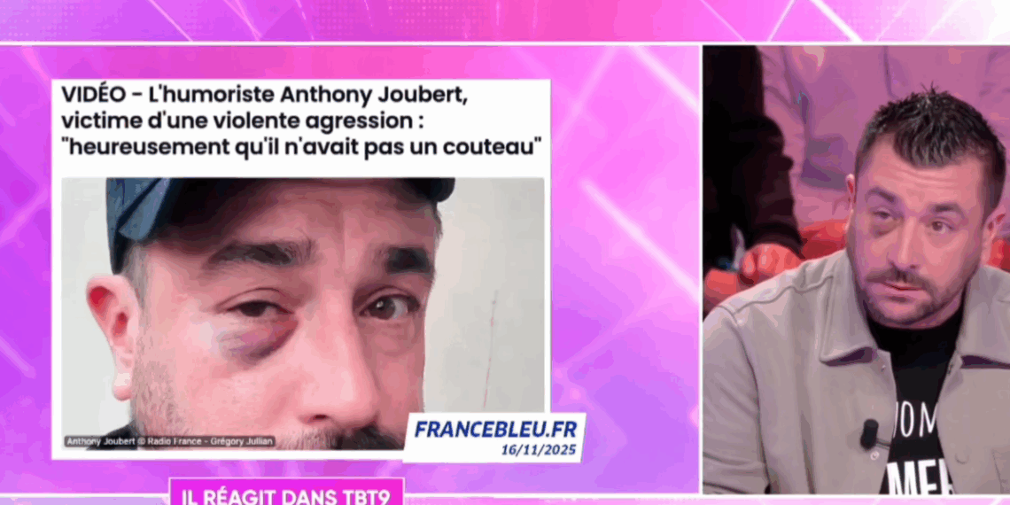 TBT9 : l'humoriste Anthony Joubert agressé dans un TER, "C'est traumatisant, pour un rien je pleure" 3 TBT9 : l'humoriste Anthony Joubert agressé dans un TER, "C'est traumatisant, pour un rien je pleure" TBT9 : l’humoriste Anthony Joubert agressé dans un TER, « C’est traumatisant, pour un rien je pleure »