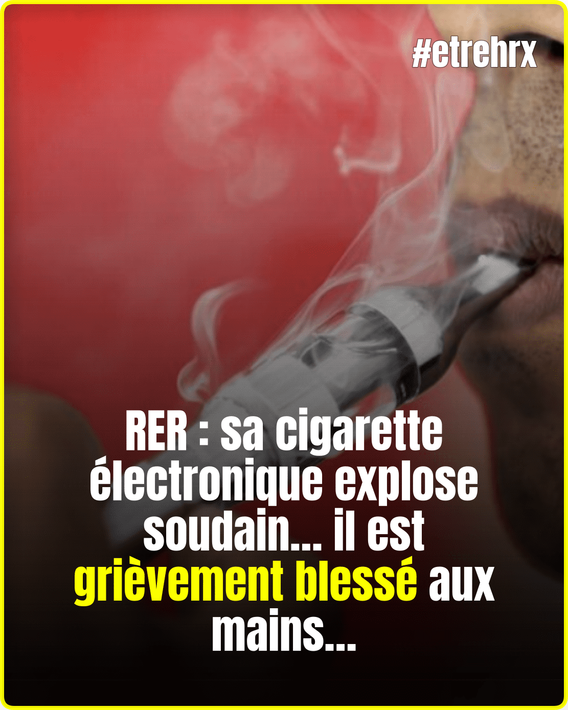RER : sa cigarette électronique explose soudain… il est grièvement blessé aux mains…