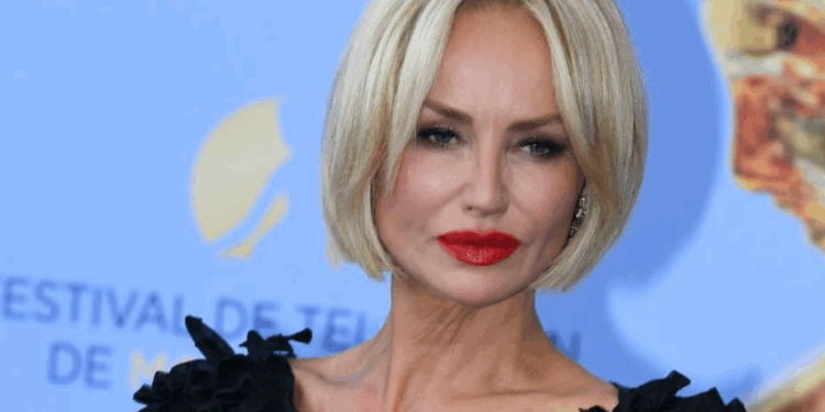 Méconnaissable, Adriana Karembeu se rase la moitié du crâne : « Les cheveux courts lui vont divinement bien » 1 Méconnaissable, Adriana Karembeu se rase la moitié du crâne : « Les cheveux courts lui vont divinement bien » Capture decran 2025 12 11 145934