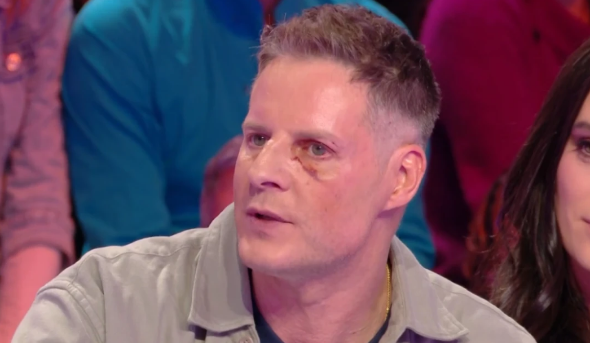 Matthieu Delormeau de retour avec un oeil au beurre noir dans TBT9 : “Personne ne croit à ce qu’il s’est passé” (VIDEO) 2 Matthieu Delormeau de retour avec un oeil au beurre noir dans TBT9 : “Personne ne croit à ce qu’il s’est passé” (VIDEO) Capture decran 2025 12 16 173027