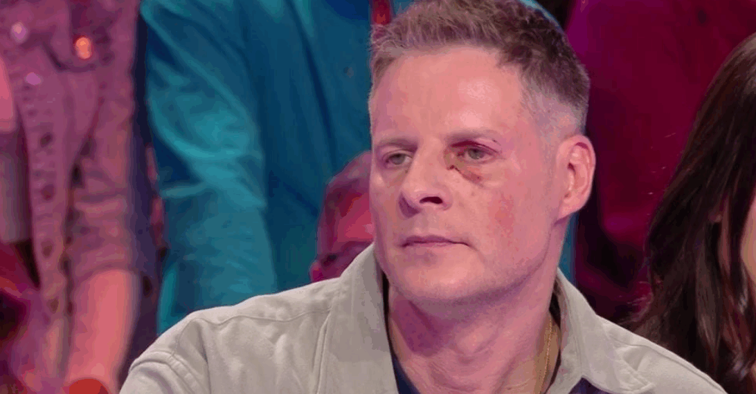 Matthieu Delormeau de retour avec un oeil au beurre noir dans TBT9 : “Personne ne croit à ce qu’il s’est passé” (VIDEO) 3 Matthieu Delormeau de retour avec un oeil au beurre noir dans TBT9 : “Personne ne croit à ce qu’il s’est passé” (VIDEO) Matthieu Delormeau de retour avec un oeil au beurre noir dans TBT9 : “Personne ne croit à ce qu’il s’est passé” (VIDEO)