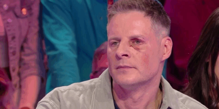 Matthieu Delormeau de retour avec un oeil au beurre noir dans TBT9 : “Personne ne croit à ce qu’il s’est passé” (VIDEO) 1 Matthieu Delormeau de retour avec un oeil au beurre noir dans TBT9 : “Personne ne croit à ce qu’il s’est passé” (VIDEO) Capture decran 2025 12 16 173032