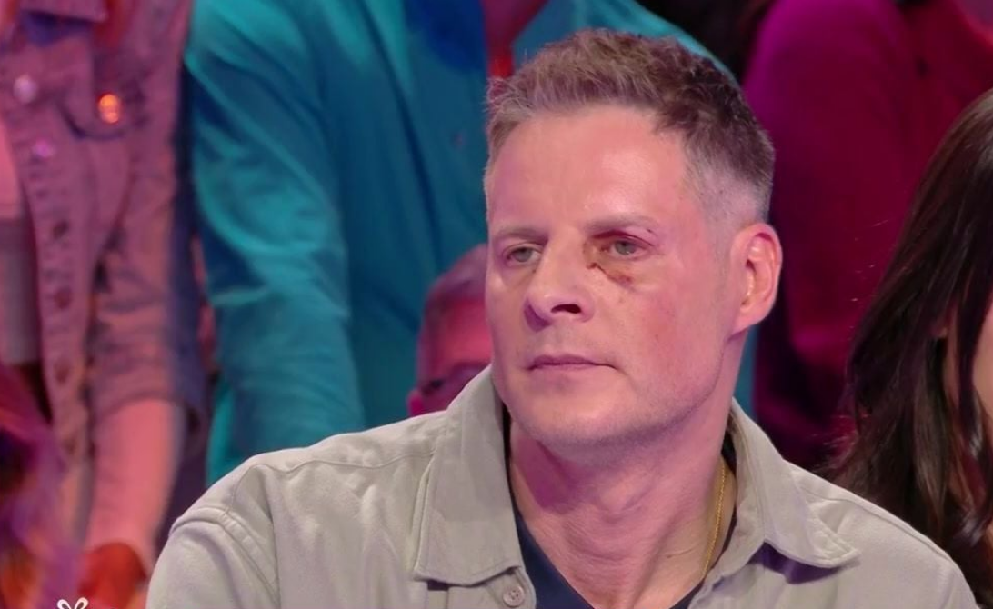 Matthieu Delormeau de retour avec un oeil au beurre noir dans TBT9 : “Personne ne croit à ce qu’il s’est passé” (VIDEO) 4 Matthieu Delormeau de retour avec un oeil au beurre noir dans TBT9 : “Personne ne croit à ce qu’il s’est passé” (VIDEO) Capture decran 2025 12 16 173032