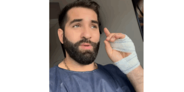Blouse bleue et bandage à la main, Kendji Girac pris en charge par des professionnels