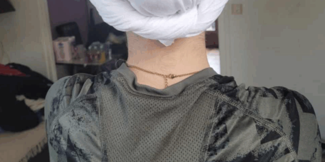 Annonay : une lycéenne exclue pour avoir porté un bonnet de chimiothérapie