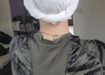 Annonay : une lycéenne exclue pour avoir porté un bonnet de chimiothérapie