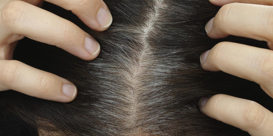 Quelle est la véritable signification, en psychologie, du fait de laisser ses cheveux grisonner naturellement ?