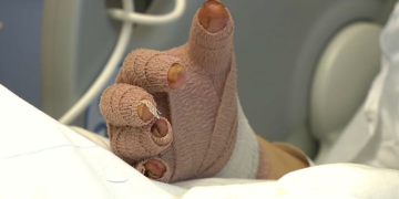 « On réentend les cris » : un mois après l’incendie de Crans-Montana, le témoignage poignant de Rose, une jeune victime de 18 ans