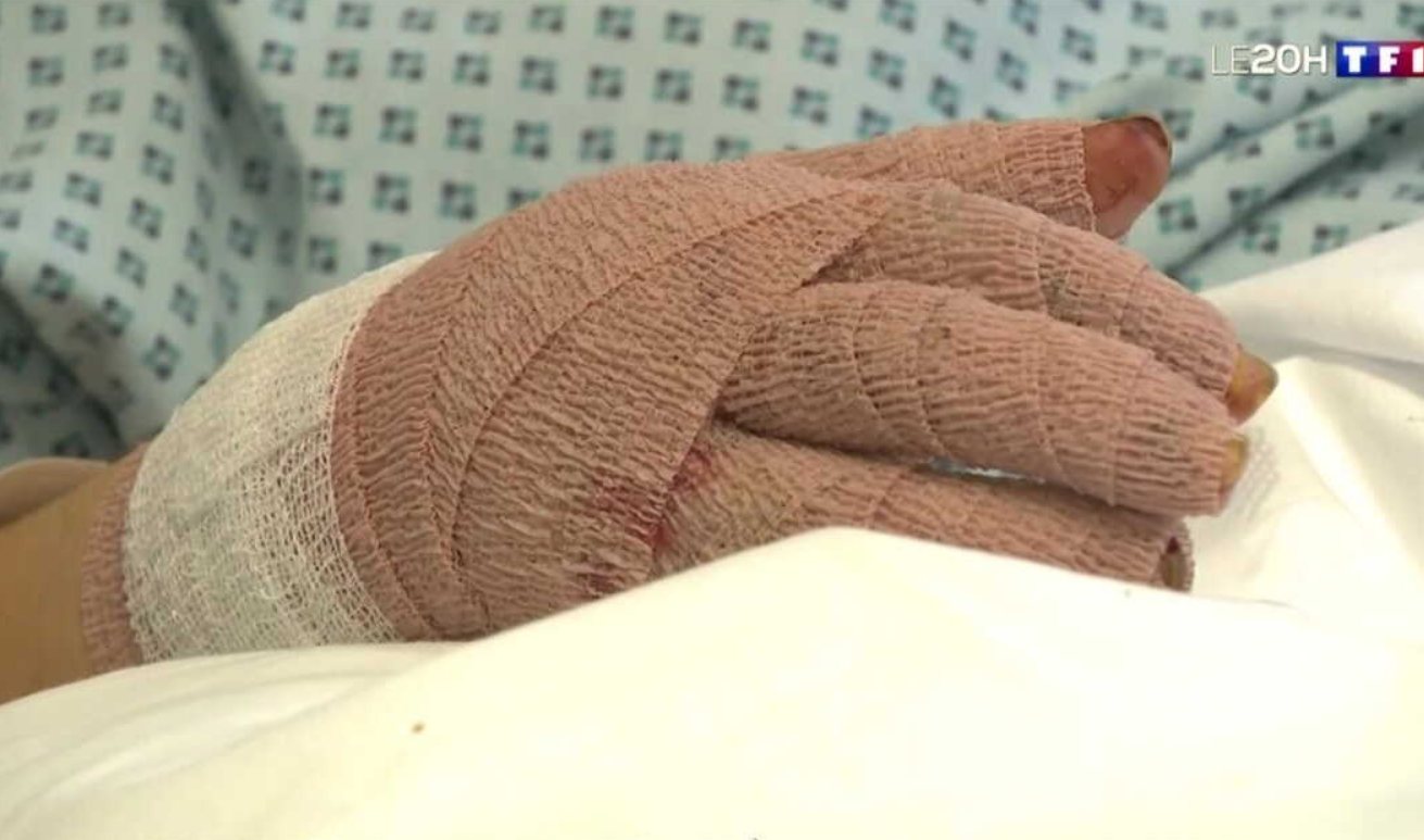 "On réentend les cris" : un mois après l’incendie de Crans-Montana, le témoignage poignant de Rose, une jeune victime de 18 ans 2 "On réentend les cris" : un mois après l’incendie de Crans-Montana, le témoignage poignant de Rose, une jeune victime de 18 ans Capture decran 2026 02 03 173202