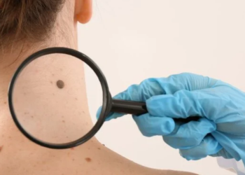 Cancer de la peau : « Je suis dermatologue et voici les 2 signes courants à détecter rapidement sur votre peau »
