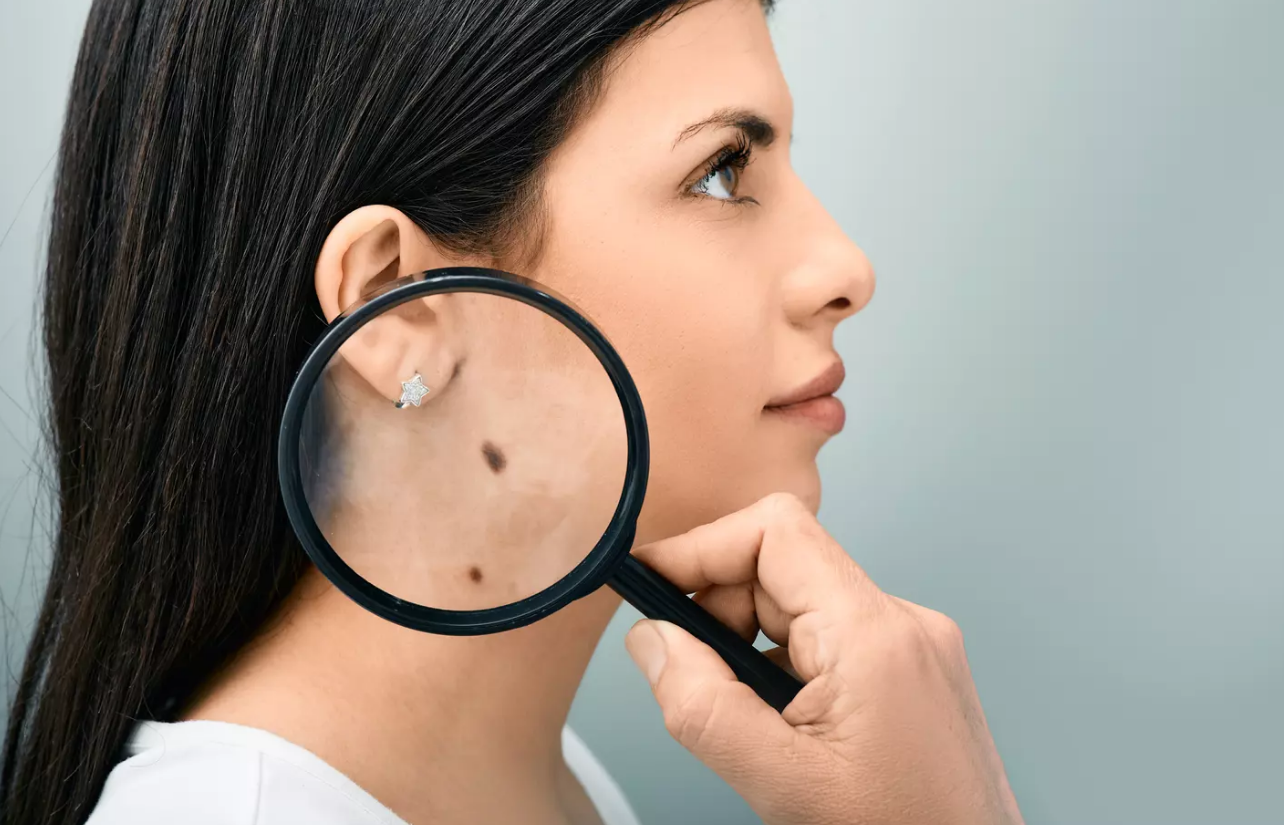 Cancer de la peau : "Je suis dermatologue et voici les 2 signes courants à détecter rapidement sur votre peau" 2 Cancer de la peau : "Je suis dermatologue et voici les 2 signes courants à détecter rapidement sur votre peau" Capture decran 2026 03 09 135310