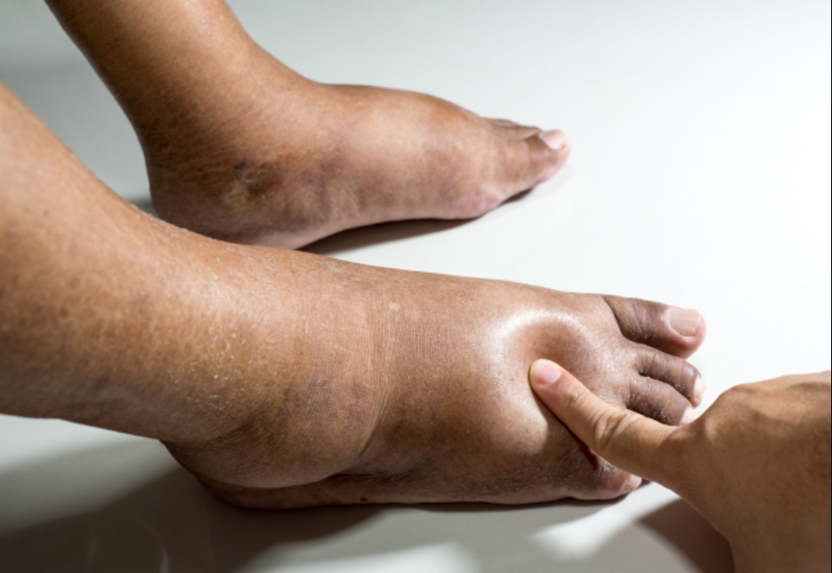 Capture decran 2026 03 11 131611