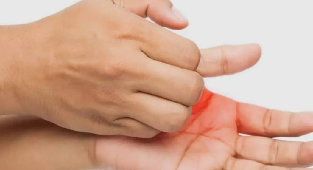 Main qui gratte sans raison apparente ? Ce phénomène intrigue beaucoup de personnes…