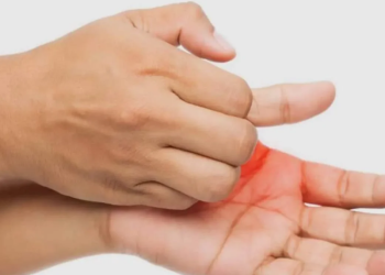 Main qui gratte sans raison apparente ? Ce phénomène intrigue beaucoup de personnes…