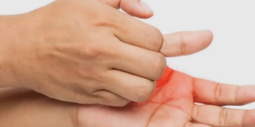 Main qui gratte sans raison apparente ? Ce phénomène intrigue beaucoup de personnes…