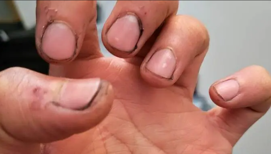 Comment appelle-t-on une personne qui a des ongles comme ça ? 3 Comment appelle-t-on une personne qui a des ongles comme ça ? Capture decran 2026 05 20 154653