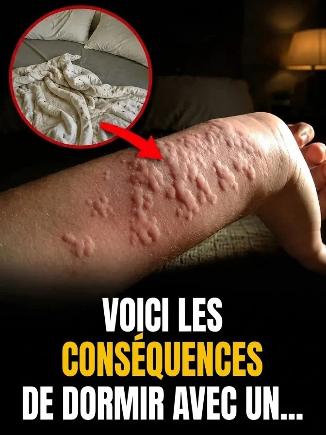 Boutons qui grattent au réveil : et si votre lit cachait un