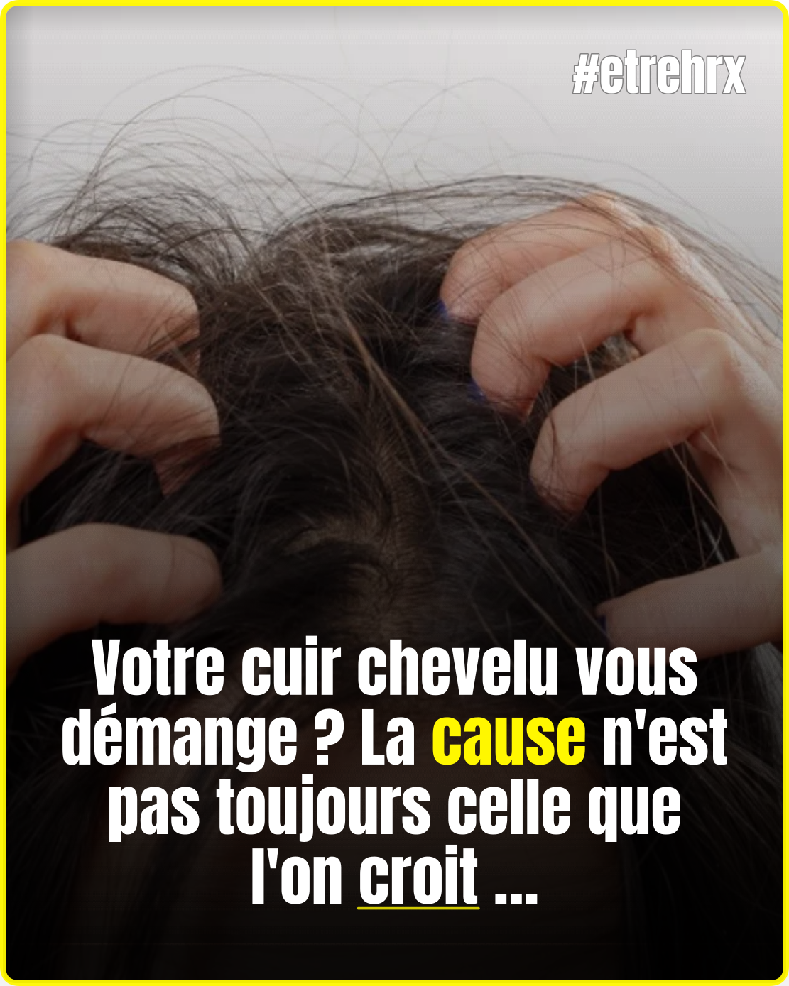 Ces démangeaisons du cuir chevelu pourraient révéler un problème inattendu…