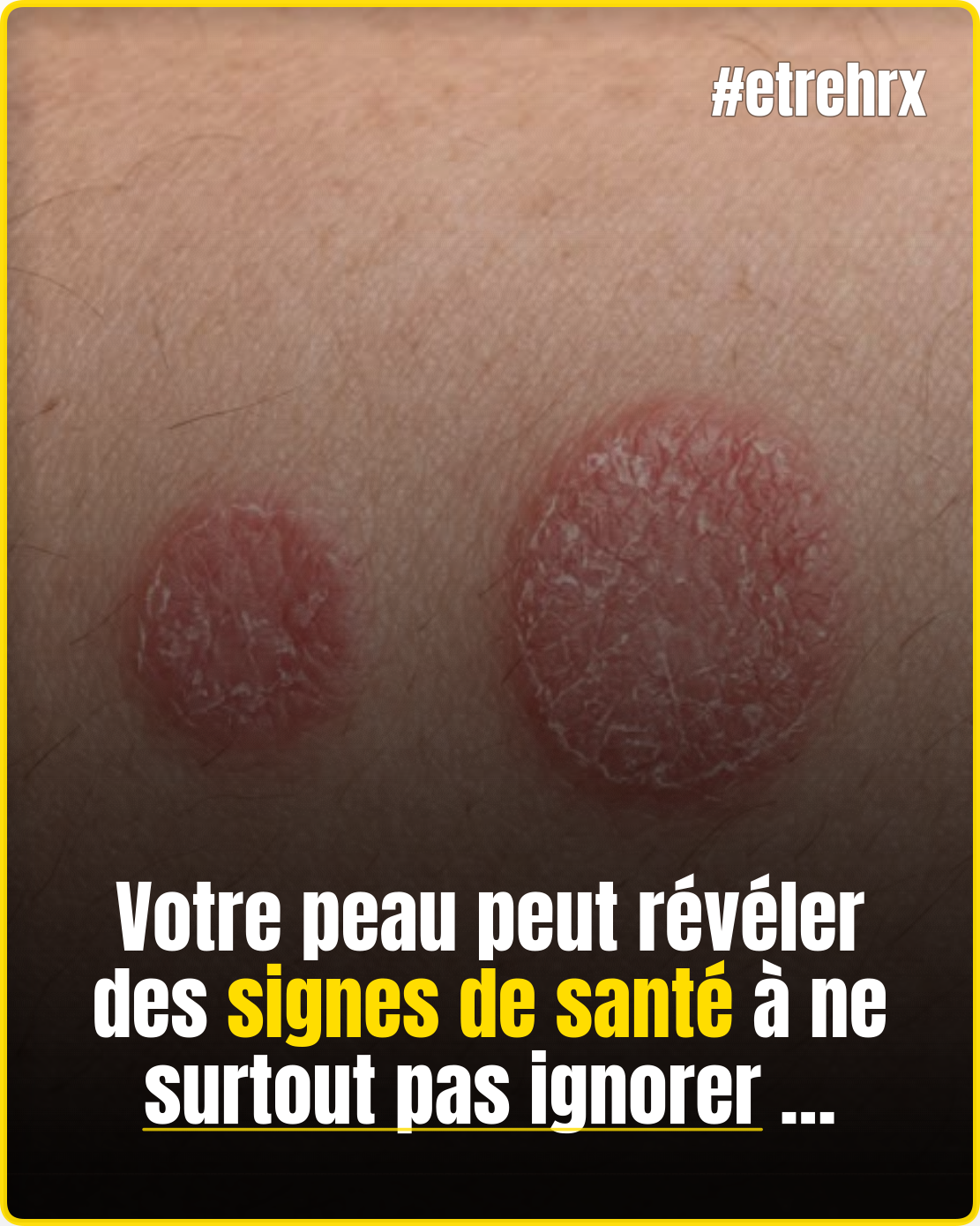 Certains signes sur la peau peuvent cacher un problème bien plus sérieux…