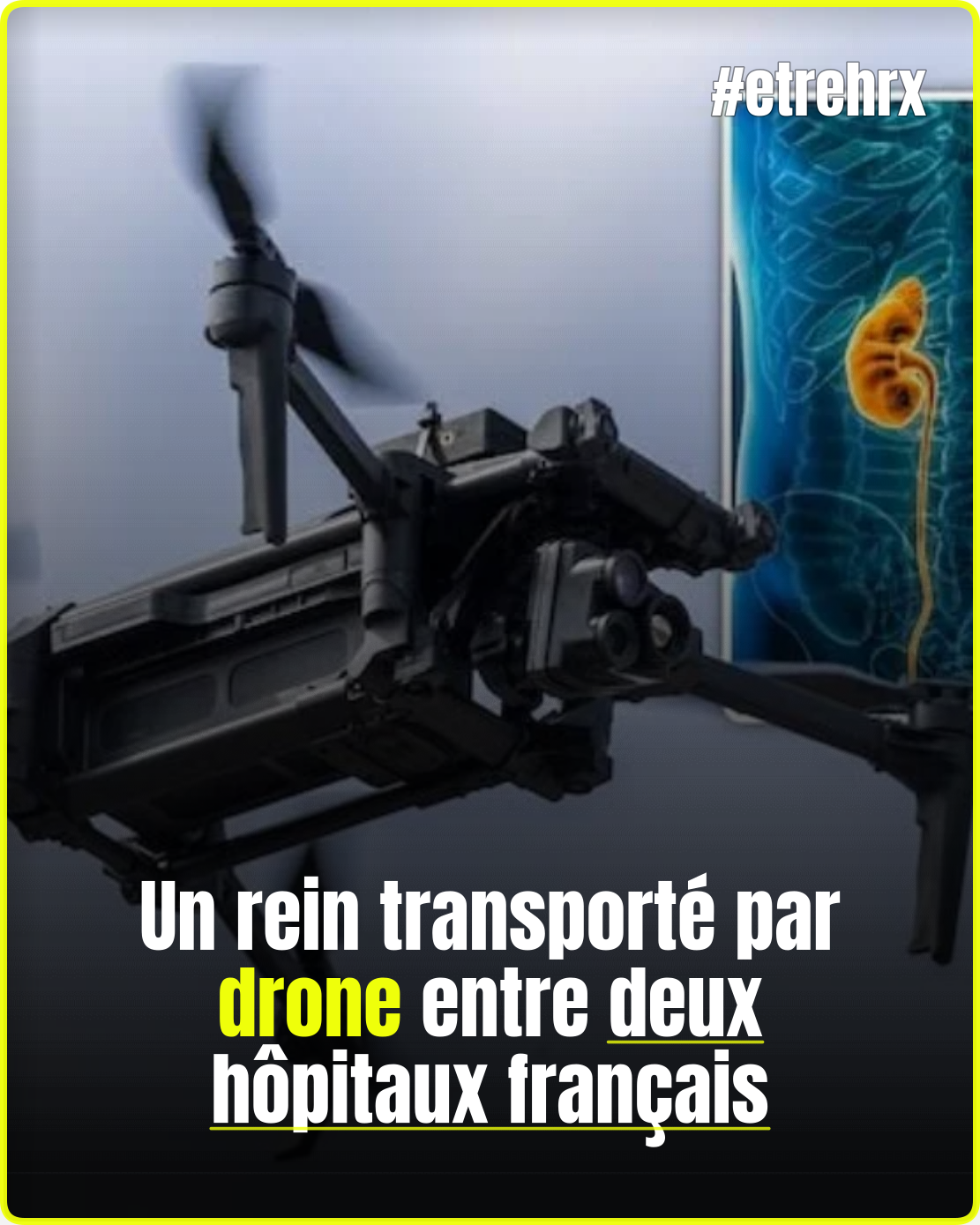 🚁 Un rein parcourt 60 km en drone entre deux hôpitaux français… une avancée qui pourrait tout changer…