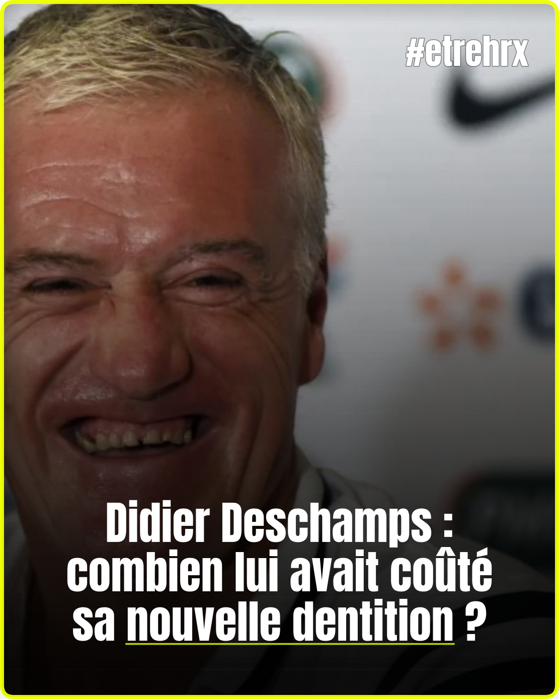 Didier Deschamps : combien lui avait coûté sa nouvelle dentition ?