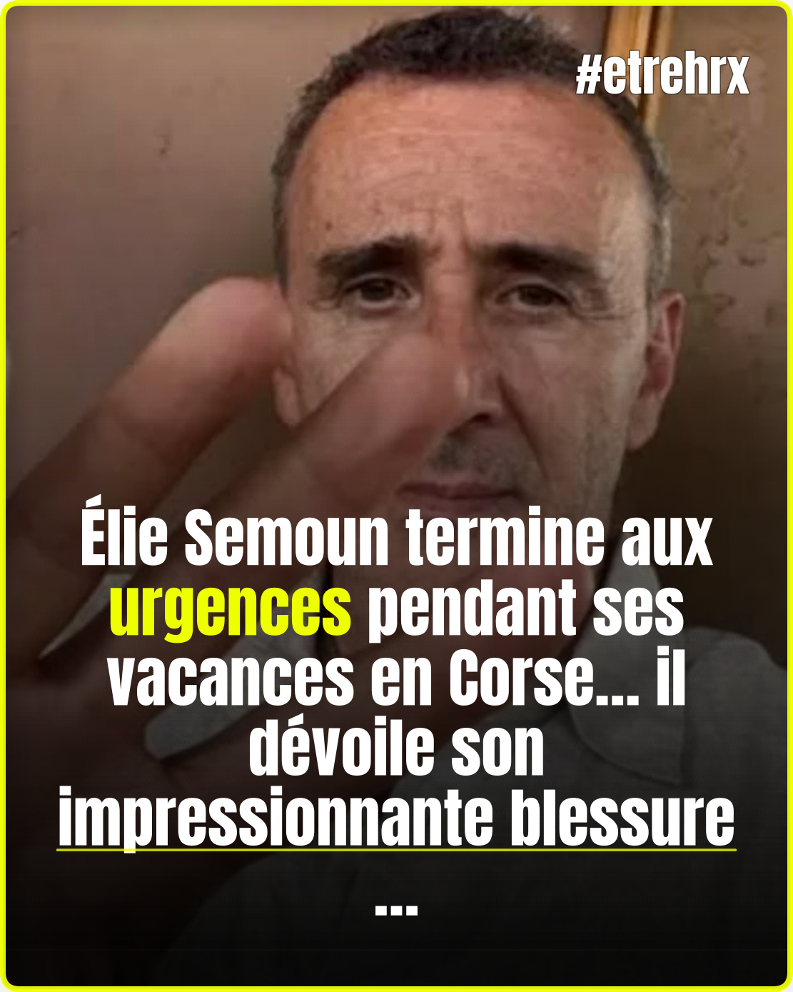 Élie Semoun victime d’un accident en Corse… la photo de sa blessure impressionne ses abonnés…