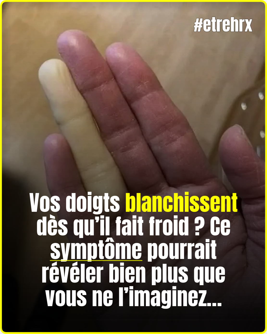 Doigts qui blanchissent dans le froid : ce que votre corps cherche