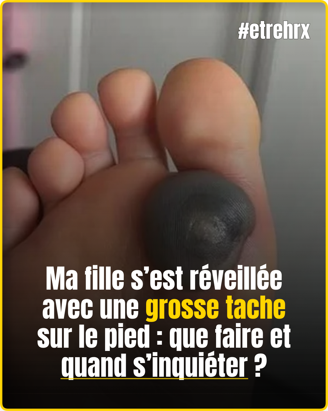 Ma fille s’est réveillée avec une grosse tache sur le pied :