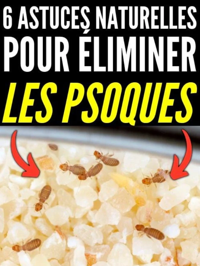 Psoques : 6 traitements naturels pour s'en débarrasser à la maison