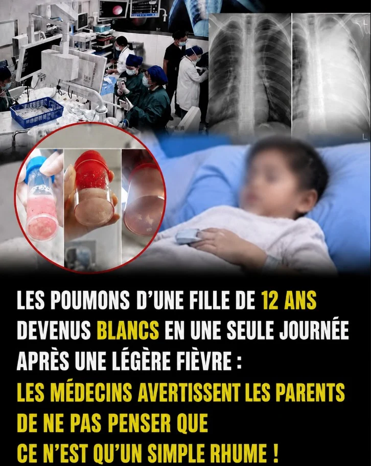 Une simple fièvre puis un « poumon blanc » en 24 h : les médecins alertent les parents sur les signes à surveiller…