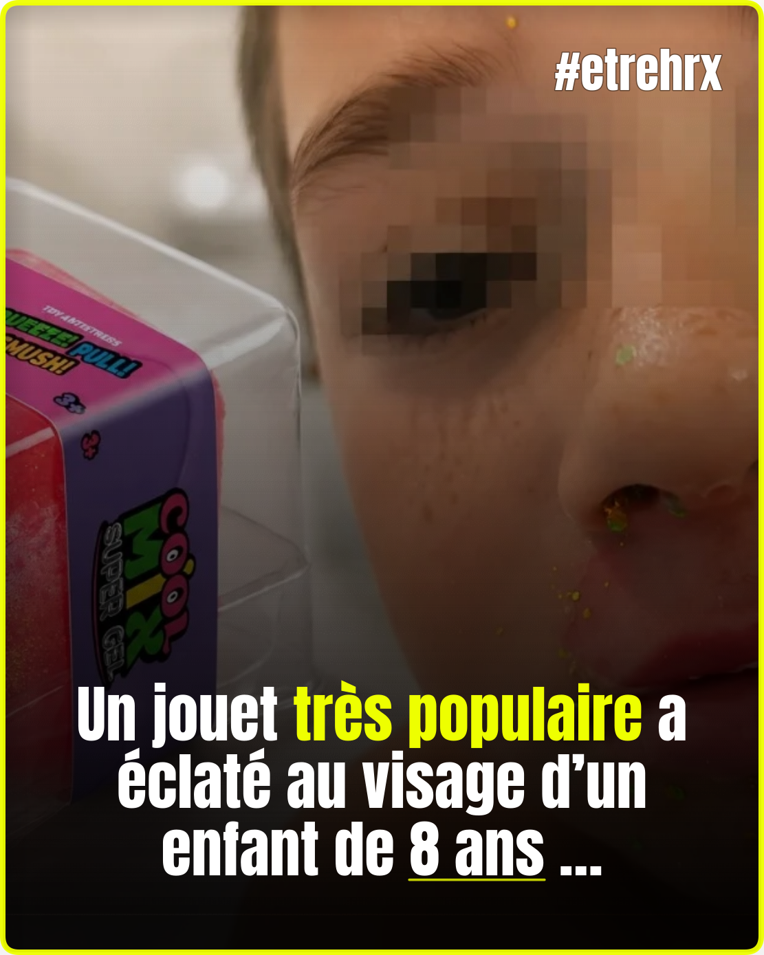 « Il lui a éclaté au visage »: un jouet « squishy