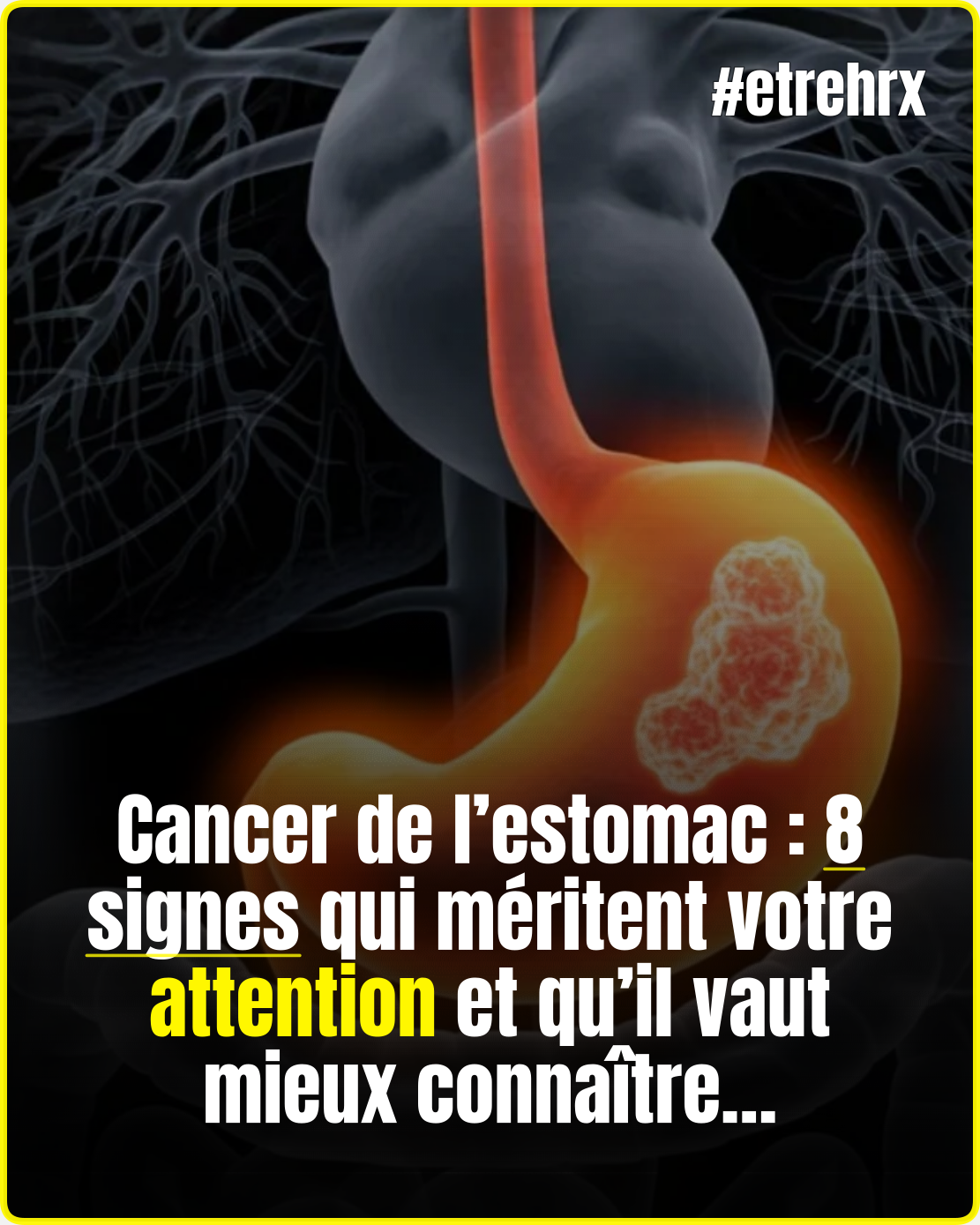 Cancer de l’estomac : 8 signaux d’alerte à connaître absolument avant qu’il