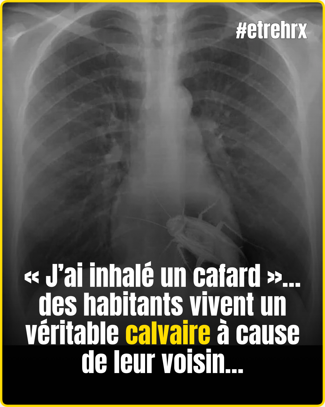 « J’ai inhalé un cafard »: des Niçois vivent un calvaire à