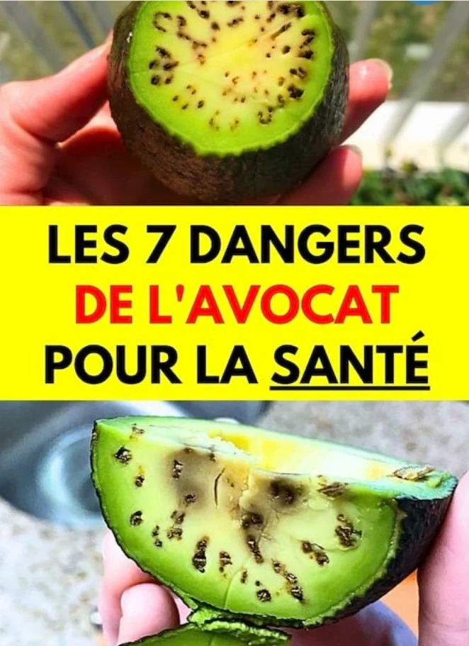 Les 7 dangers et méfaits de l&rsquo;avocat pour la santé