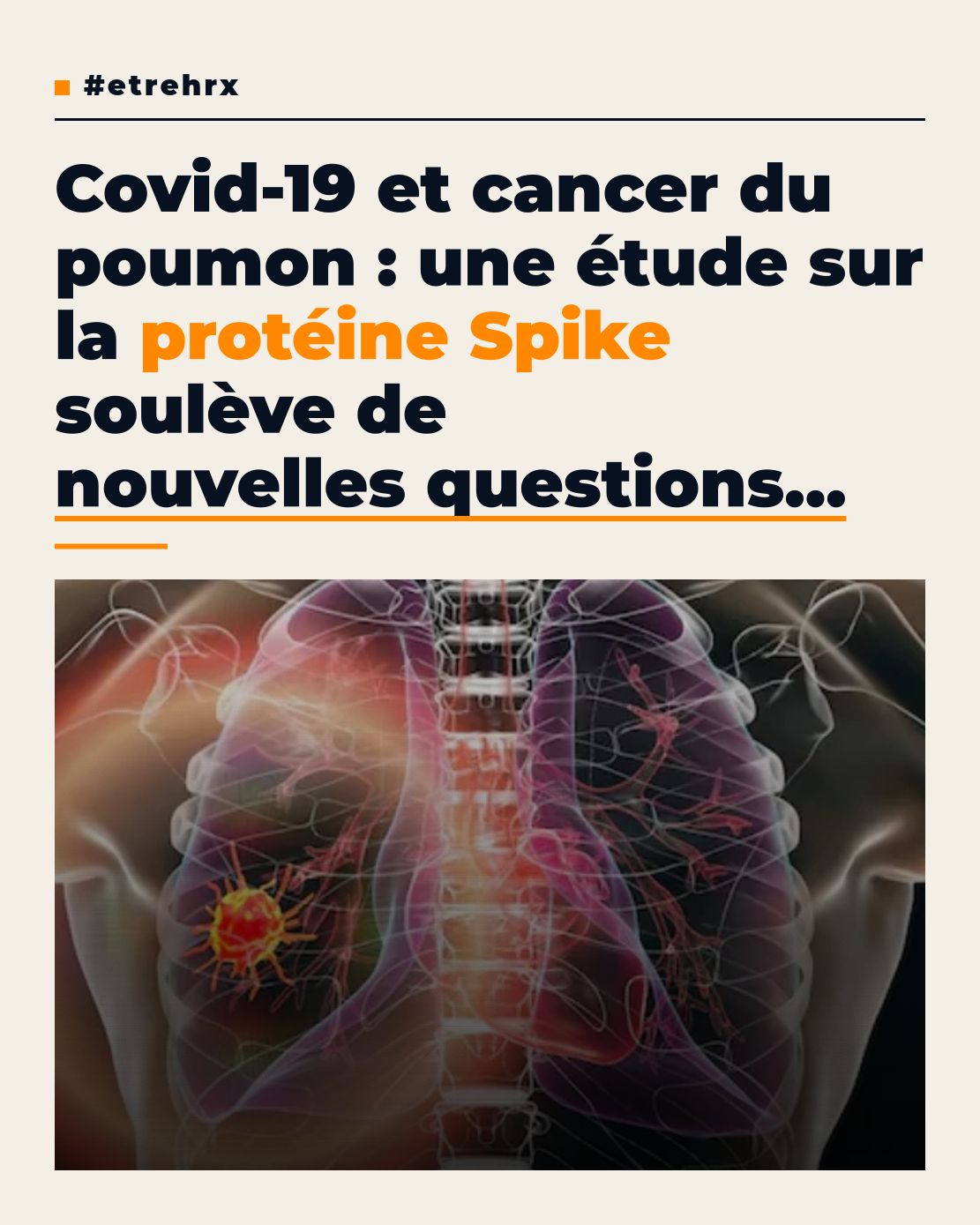 Covid-19 et cancer du poumon : cette découverte sur la protéine Spike