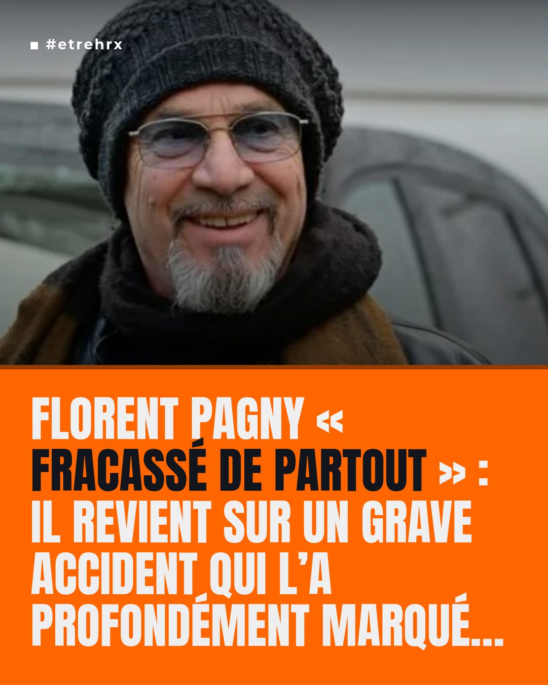 Florent Pagny « fracassé de partout » : points de suture, «