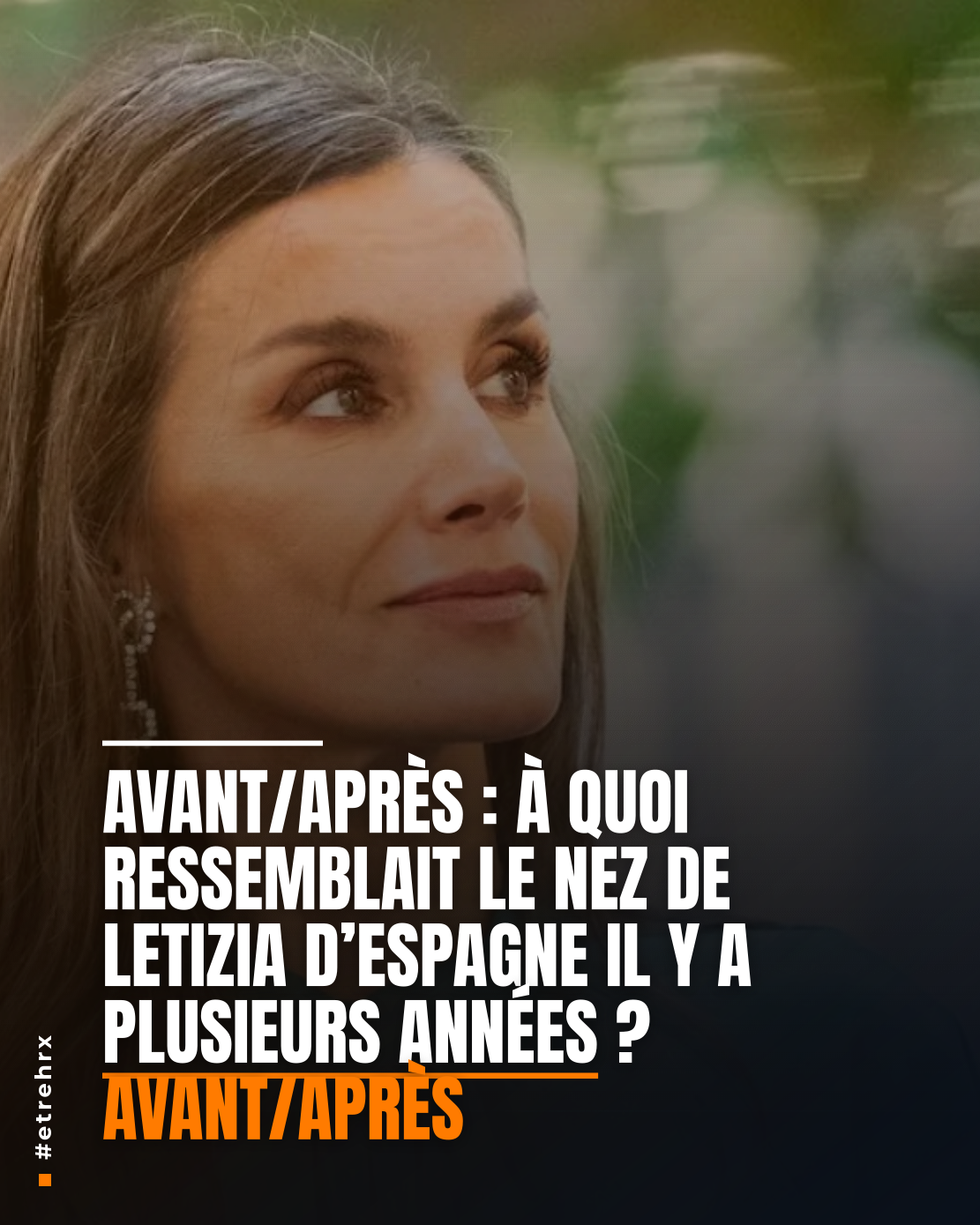 Avant/Après : à quoi ressemblait le nez de Letizia d’Espagne avant la