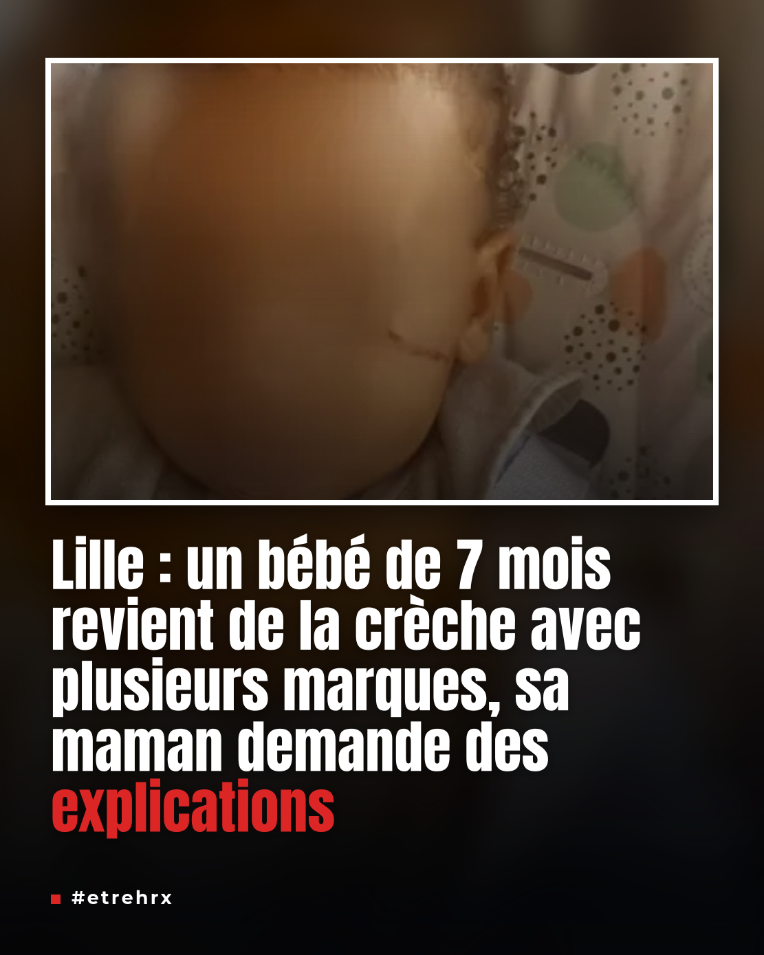 Une maman récupère son bébé de 7 mois avec une blessure sous