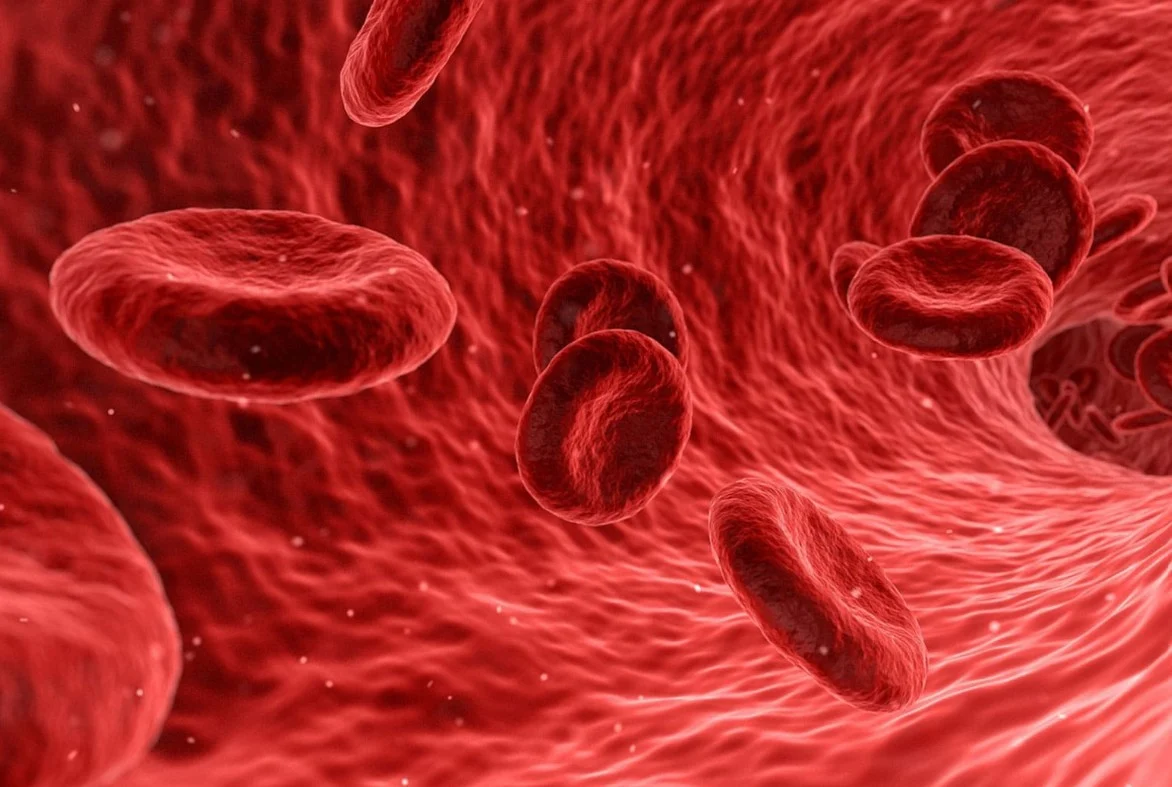 sanguine (4) sanguine (4)